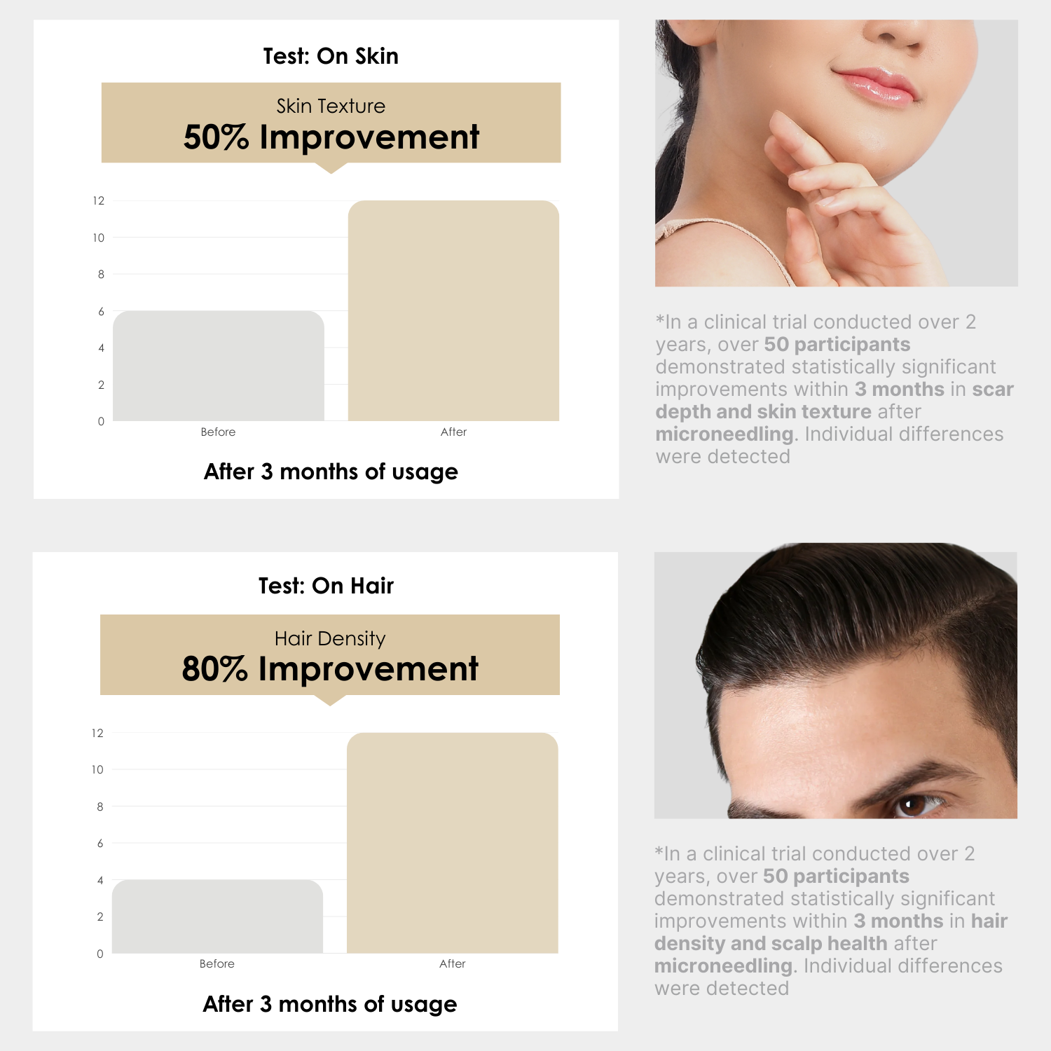 Apestomen Derma Roller Medical-Grade 540-Pin Titanium Derma Roller Mirconeedling Skin Rejuvenation & Beard, Hair Growth